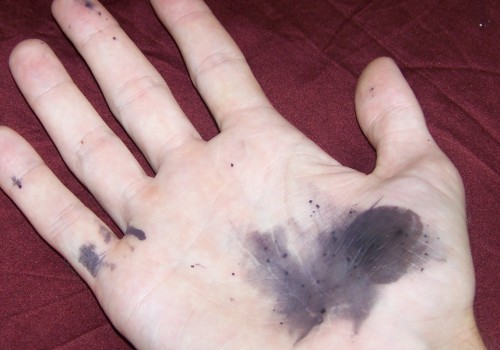 The Truth About Silver Nitrate and Its Effects on Skin